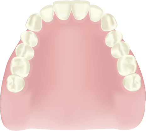 レジン床義歯（保険診療で使用される一般的な義歯）
